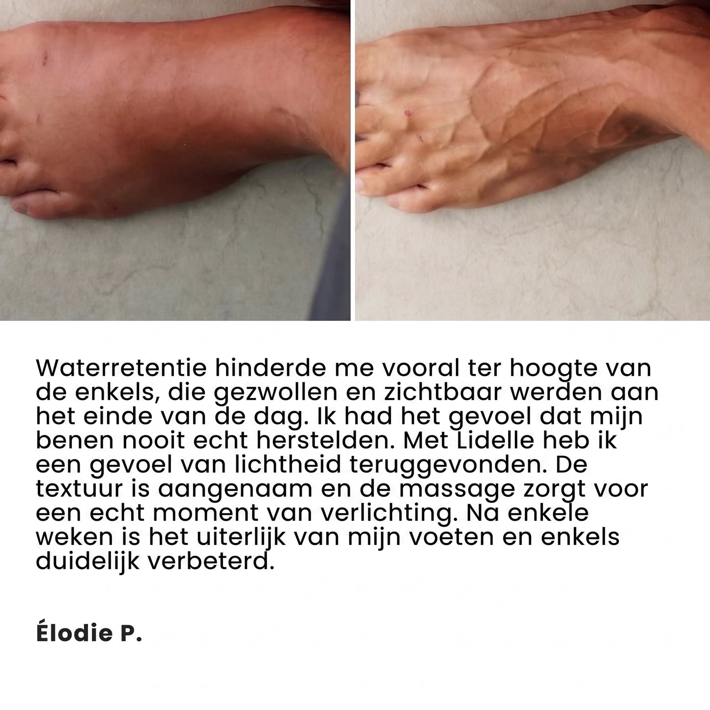 Wonderbalsem - Lindelle